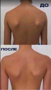 Фотография Симметрия 5