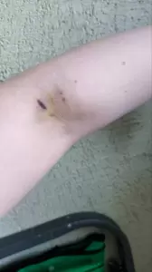 Фотография Гемотест 5